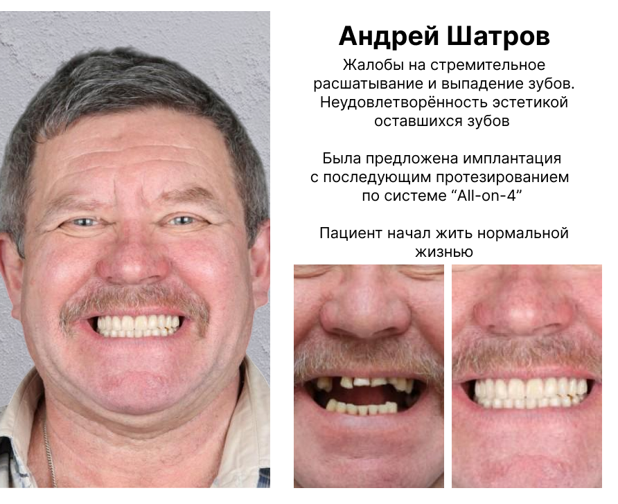 Image title
