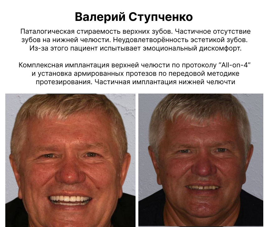 Image title
