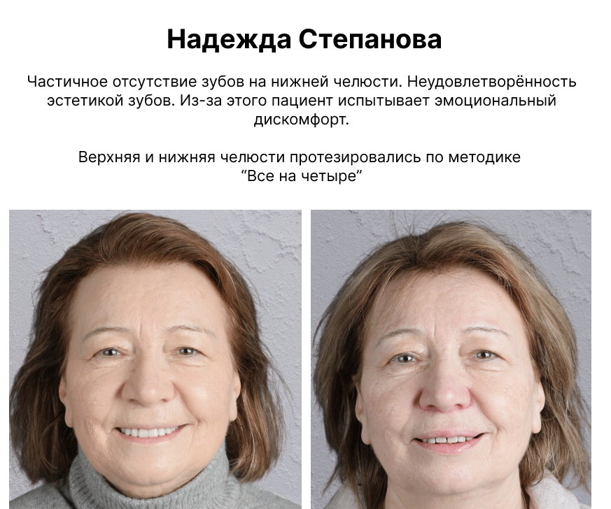 Image title